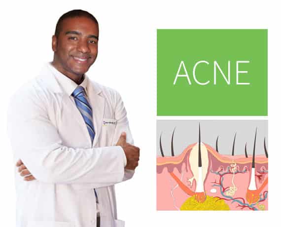 Allery-ASthma-Center-Severe-Acne-Treatment-Vital-Allergy